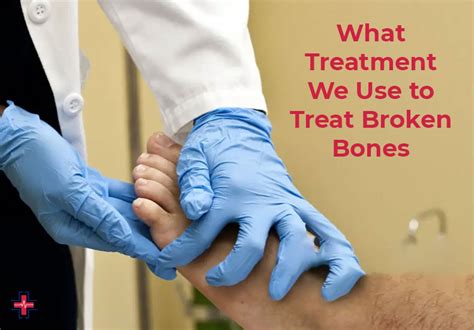 Broken Bones Fractures Types Causes Symptoms And Treatment Er