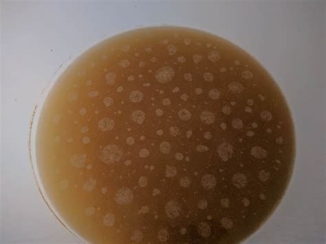 Infection? : Homebrewing