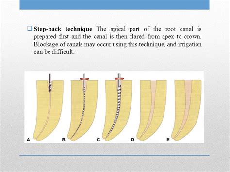 Степ бэк схема - Фото подборки 3
