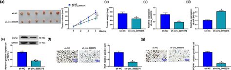 Circ Knockdown Suppresses Non Small Cell Lung Cancer Cell Tumor