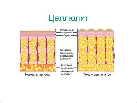 Ингибитор жира - презентация онлайн