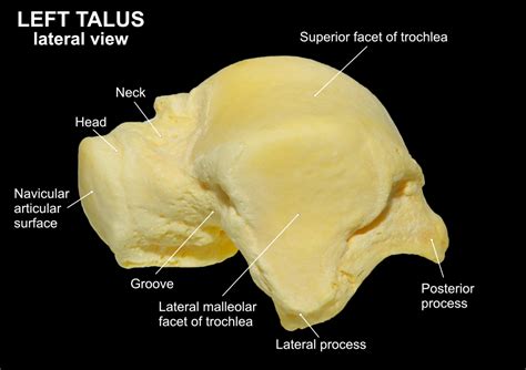 TALUS – Clinical Anatomy