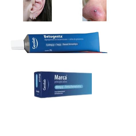 Qual A Melhor Pomada Para Piercing Inflamado