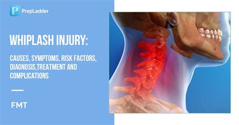 Whiplash Neck Injury Morse Road Doctor: Whiplash & Neck Pain Treatment