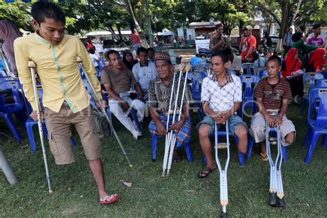 Pengukuran Kaki Tuna Daksa Antara Foto
