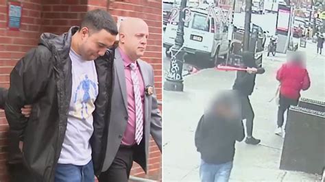 Suspected Nyc Baseball Bat Attacker Released On 7 500 Bail Day After Brutal Assault Fox News