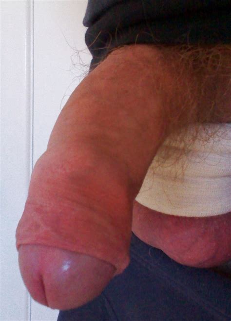 Uncut Cock Porn Pictures XXX Photos Sex Images 1385437 PICTOA