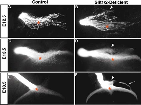 schematic   expression  slit  slit   summary