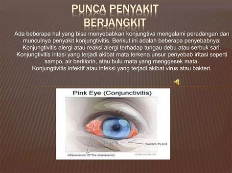 Tandapunca And Cara Mencegah Penyakit Berjangkit Ppt