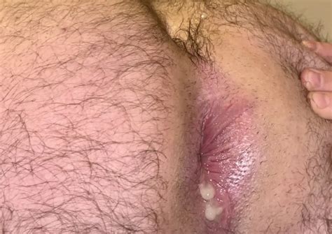 Playing With My Cum In My Ass Goes In Frozen Juicy Out 5 Nude Pics XHamster