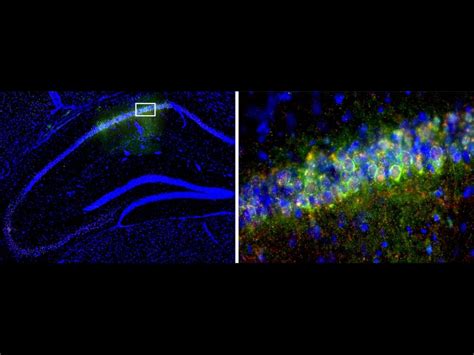 Circadian clock gene helps mice form memories better during the day