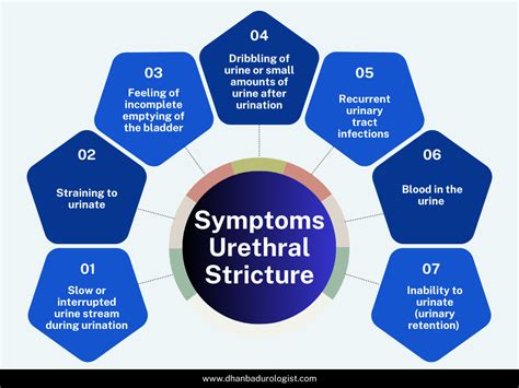 urethral stricture  symptoms  treatment options