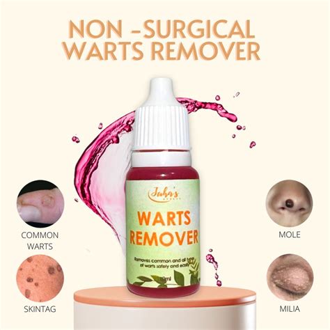 Effective Pure Kasoy Oil Warts Remover Mole Millia Syringoma Skintag