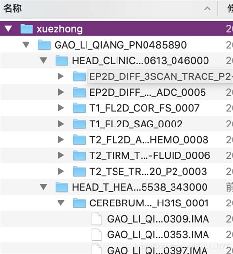 Dicom文件ima批量转化为niftinii文件ima格式转换为nii格式 Csdn博客