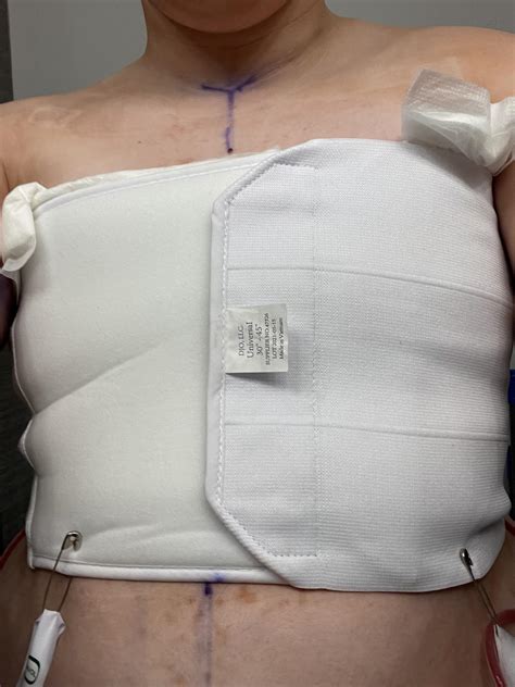 After a year of fighting with my insurance, I was finally able to say