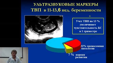 25.02.2015 Современные методы пренатальной диагностики - YouTube