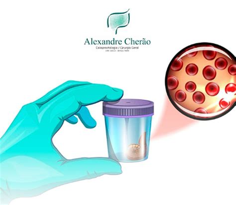 Exame De Sangue Oculto Nas Fezes Pode Tomar Cafe - Exame de sangue oculto nas fezes. Você já fez?