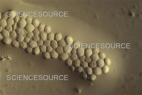 Lm Of Saccharomyces Cerevisiae Stock Image Science Source Images