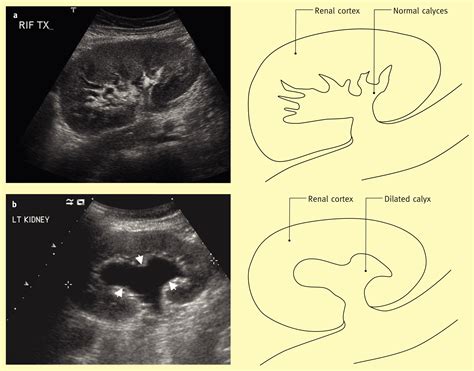 Renal Imaging Medicine