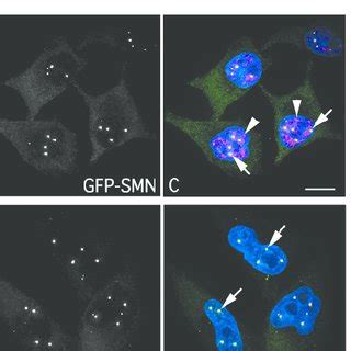 Stable Cell Lines Expressing Gfp Smn Show Normal Nuclear Morphology