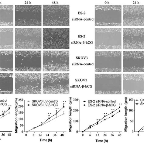 Transwell Assay Showed That Hcg Regulates Ovarian Cancer Cell