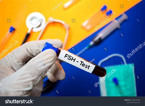 Fsh Test Blood Sample Top View Stock Photo 1460375996 | Shutterstock