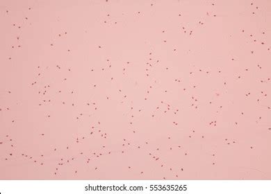 155 Sperm Vagina Stock Photos Images Photography Shutterstock