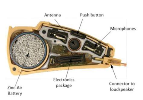 Sound Design: The Anatomy of a Modern Hearing Aid - Medical Design and ...