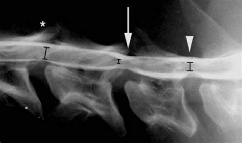 wobbler syndrome canada west veterinary specialists