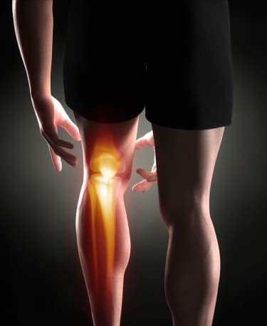 ACL Injury Prevention Program Strategies - Form & Function Physical Therapy