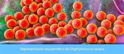 PLM Dermatología Foliculitis causas infecciosas y cuidados