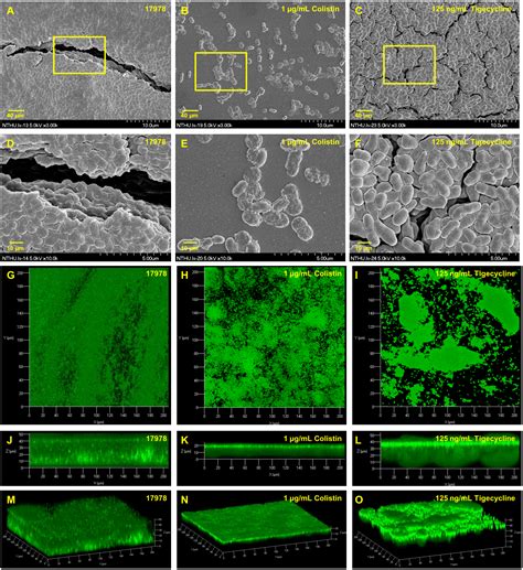 Characterization Of Biofilm Production In Different Strains Of