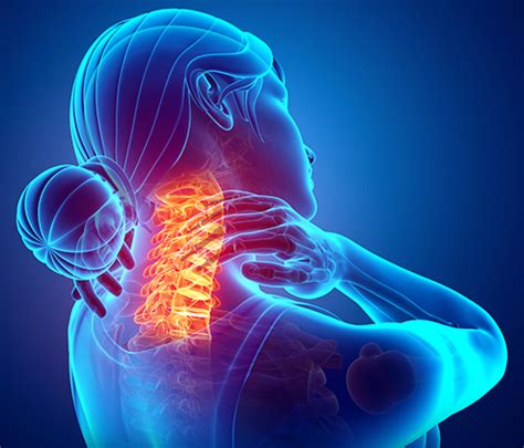 Preparing for Your Cervical Spinal Fusion