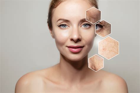 dull skin condition vancouver laser skin care centre