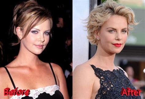 Charlize Theron Plastic Surgery Rumors True Or Just Good Genes