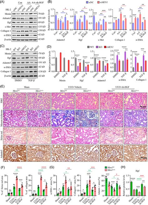 Recombinant Human Hepatocyte Growth Factor HGF Ameliorates Renal