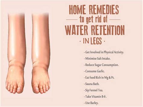 How To Stop Retaining Water In Legs