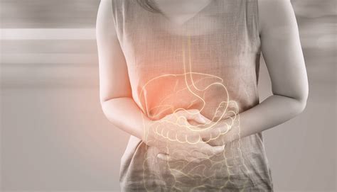 Síndrome del intestino irritable