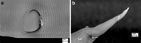 Scanning Electron Micro Graph Of Posterior End Of The Female O