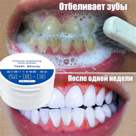 Жемчужный порошок для отбеливания зубов быстро удаляет желтые пятна от ...