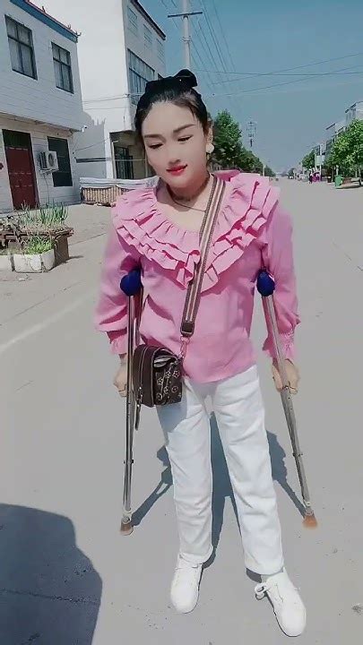 Polio Beautifull And Charming Polio Girl Walking With Crutches Youtube