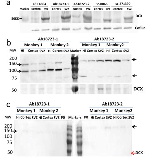 Comparison Of Western Blot Assays Of The Adult Macaque Brain Using The