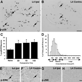 L Drg Neurons Are Predominantly Spared Neurons In The L Snl Model