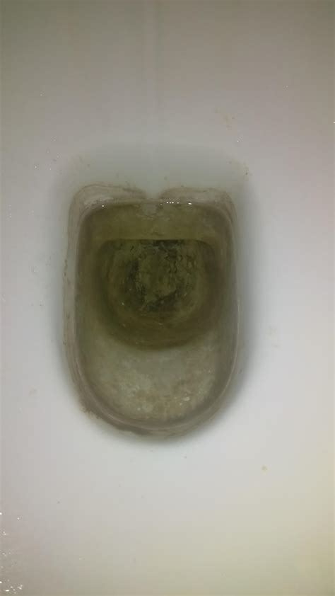 urine that sinks to the bottom of the toilet 1