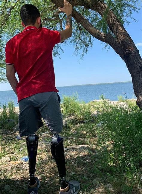 Gay Amputee Fetichism And Others