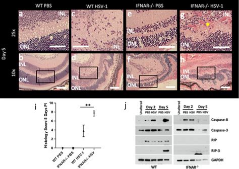 Loss Of Ifn Signaling Results In Worse Pathology Wt And Ifnar −− Mice