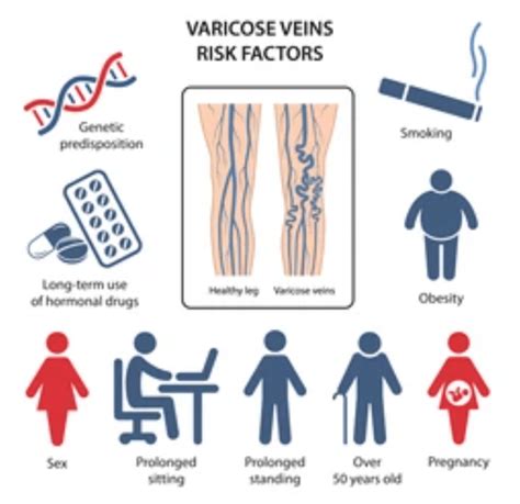 Research Unveiled 7 Groundbreaking Advances In Varicose Vein Diagnosis