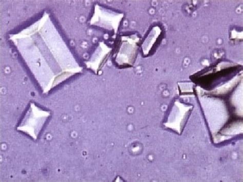 Струвиты в моче у кошки: лечение, причины, профилактика