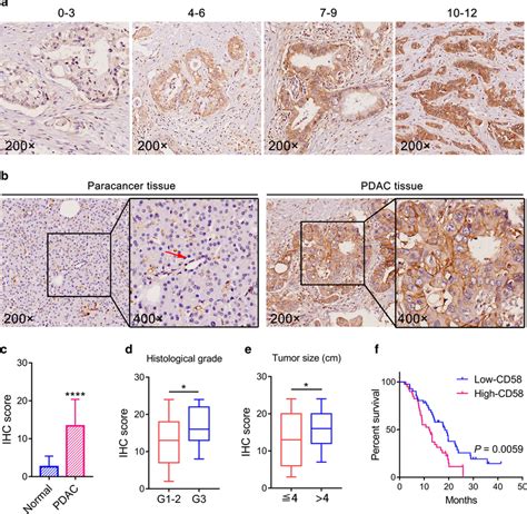 Cd Expression In Pdac Tissues And Para Cancer Normal Tissues By Using