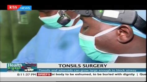 The Process Of Tonsils Surgery Health Digest Youtube